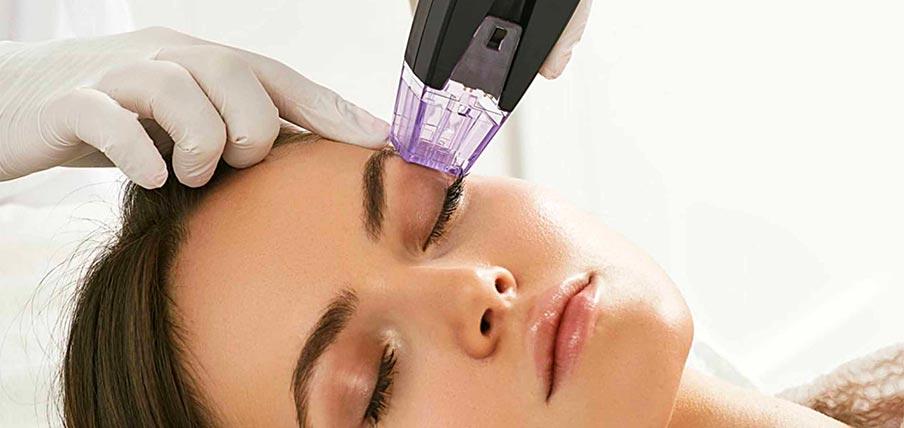 Morpheus radiofrequenza frazionata